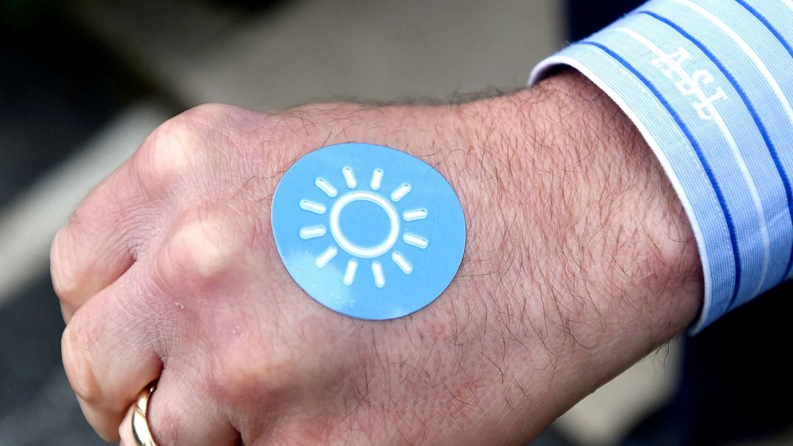 PHOTO: In this May 21, 2015, file photo, a man wears a Sunburn Alert sticker on his hand in Westminster, Md.