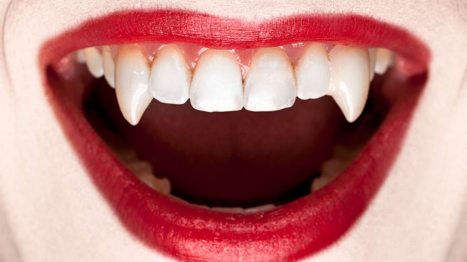 Dentists warn against these vampire fangs Halloween hacks on. 