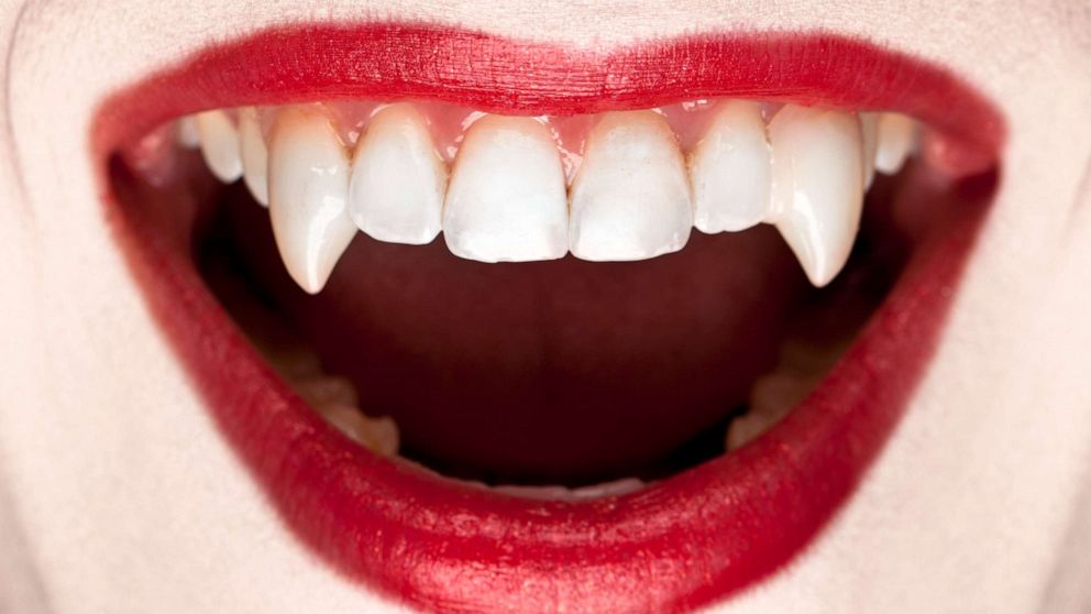 Dentists warn against these vampire fangs Halloween hacks on TikTok ...