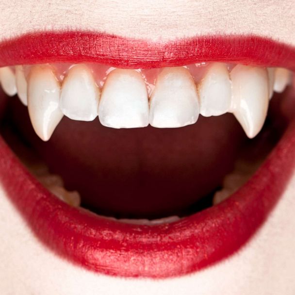 Dentists warn against these vampire fangs Halloween hacks on TikTok ...