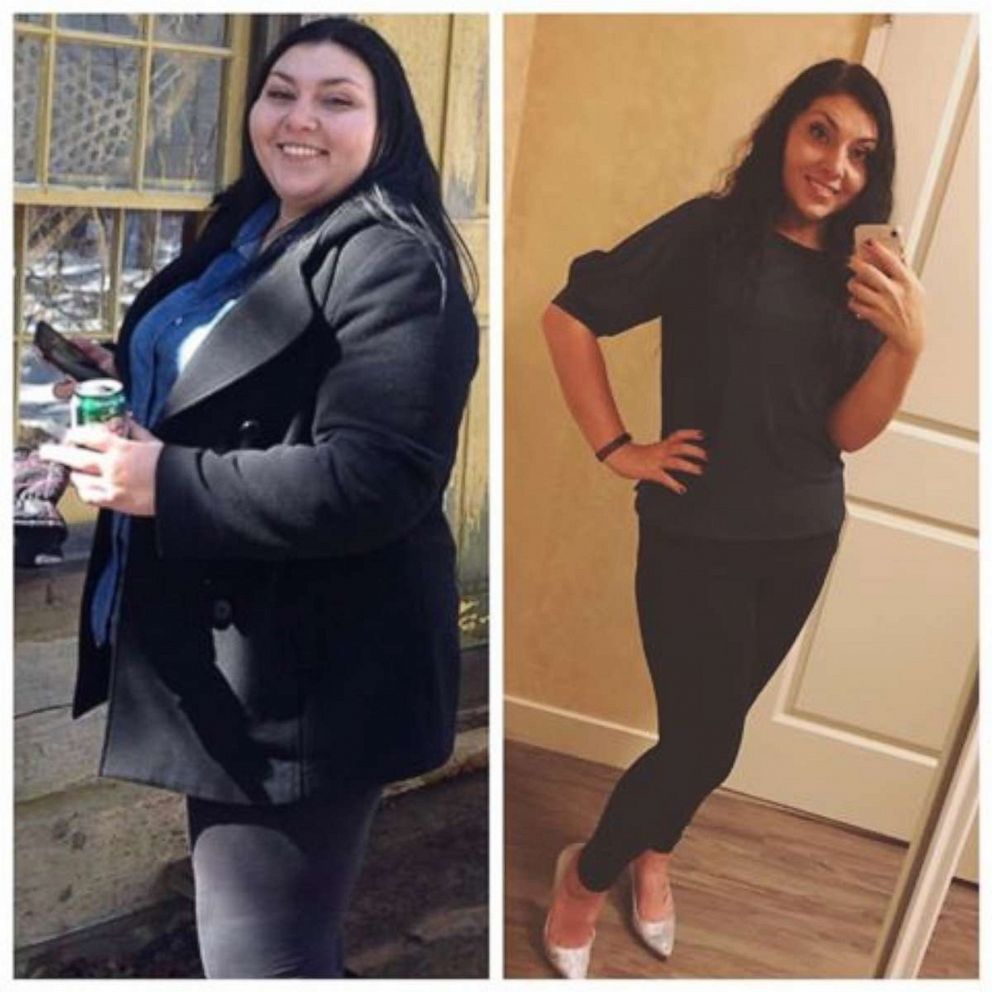 Woman loses over 100 pounds following 'lazy keto' diet - Good Morning  America