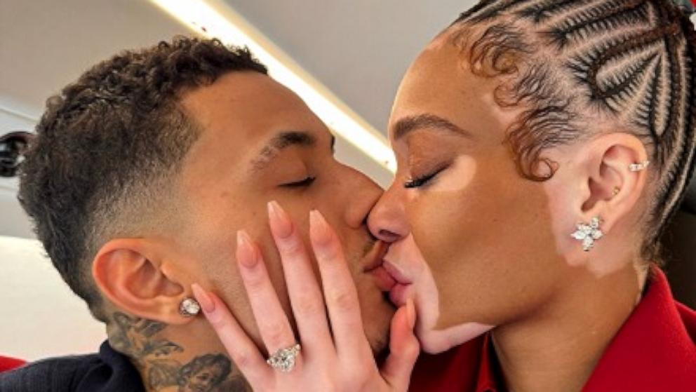 PHOTO: In this photo posted to their Instagram accounts, Winnie Harlow and Kyle Kuzma are shown after becoming engaged.