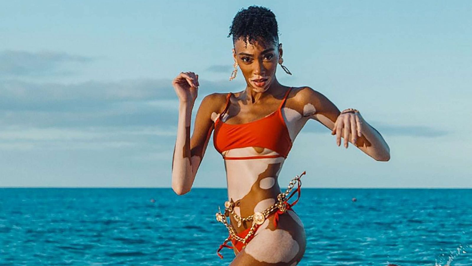 PHOTO: Winnie Harlow is pictured in this photo posted on Instagram by Jamie Bruce.