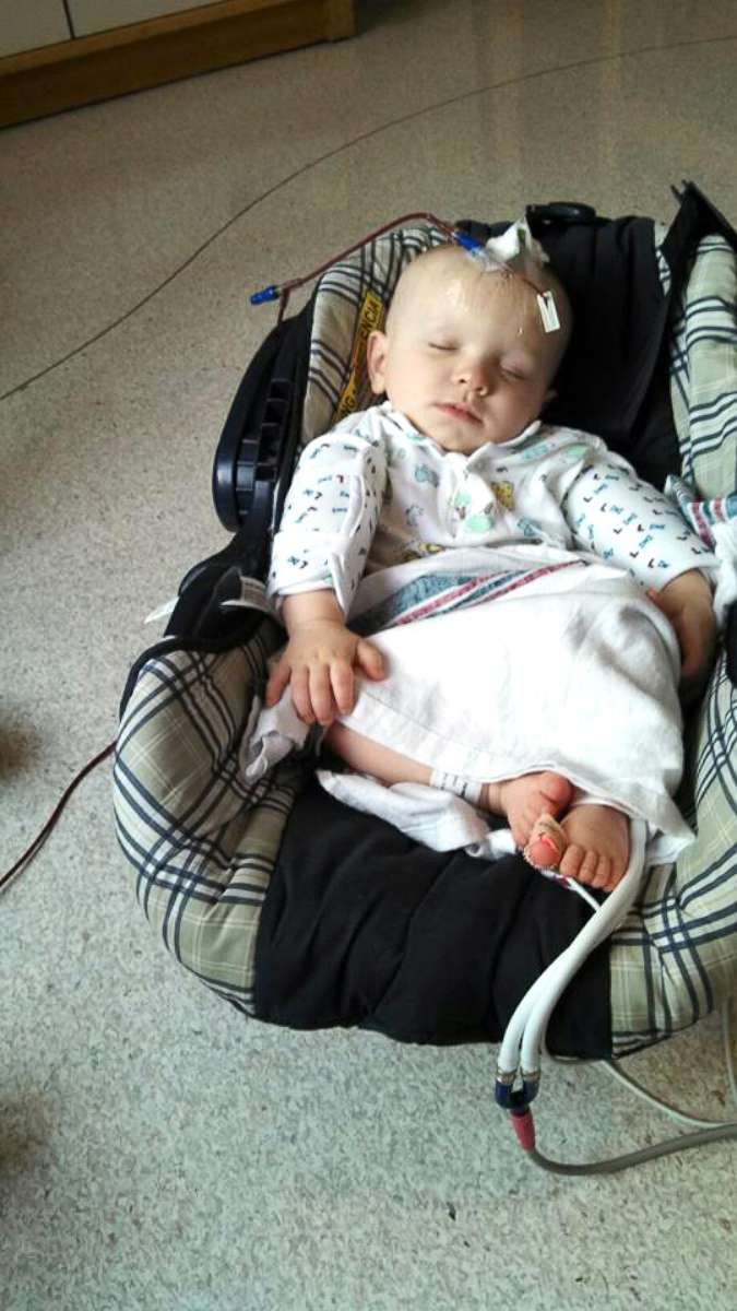 PHOTO: Gabriel Smith, now 7, sleeps through a platelet transfusion as an infant.