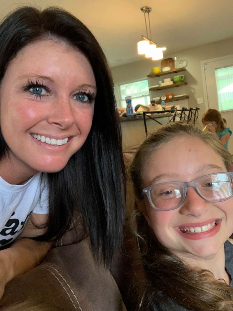 PHOTO: Alicia Renee Phillips, a mom of three from Clinton, Tennessee, took to Facebook on July 7, to describe how styling her sister Gracie Brown's hair strangely led to an emergency room visit.