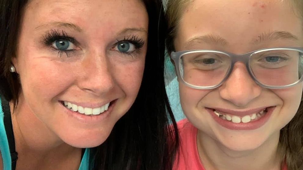 PHOTO: Alicia Renee Phillips, a mom of three from Clinton, Tenn., took to Facebook last week, to describe how styling her 10-year-old sister Gracie Brown's hair led to an emergency room visit.