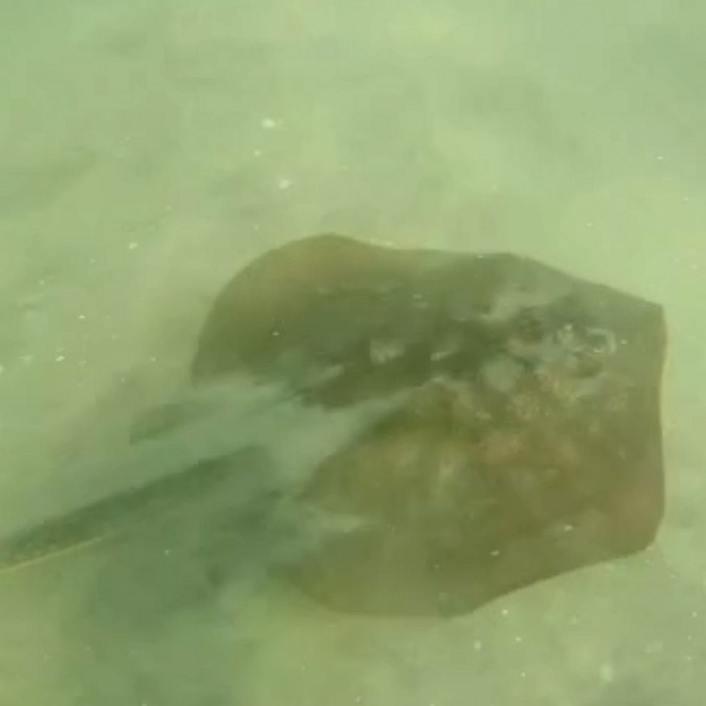 Baby Stingray Sting