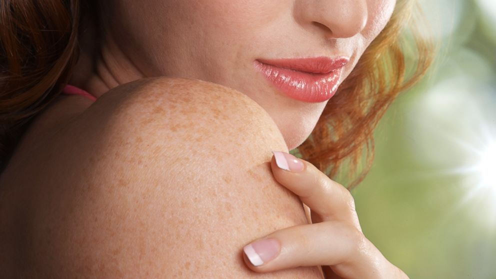 Skin troubles are sometimes related to other health problems.