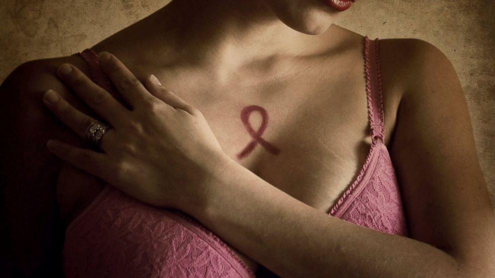 Breast Density Matters for Cancer Screening, Study Finds - ABC News