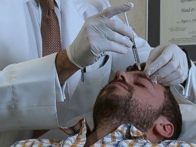 VIDEO: Doctors say that unlike women, men want their Botox to leave some lines behind.