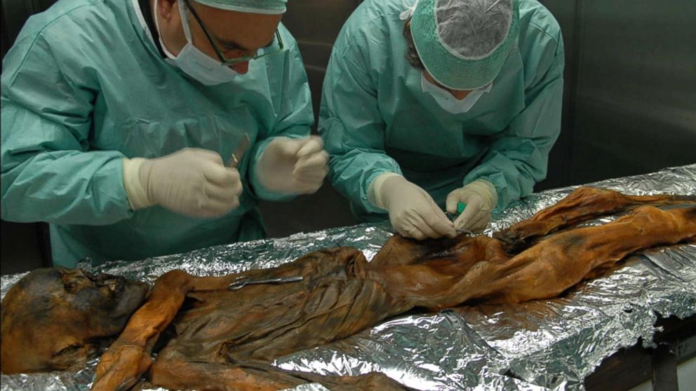 Secrets Of Iceman How A 5 300 Year Old Mummy Sheds Light On Evolution Migration Abc News