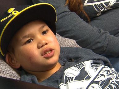 VIDEO: Masen Lopes, 7, was diagnosed with Stage 3 Astrocytoma, a type of brain cancer, just months after his father died from the same disease.