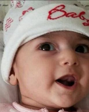 VIDEO: Doctors say that baby Fatemeh is "doing well" after undergoing surgery on Friday to repair a heart defect.