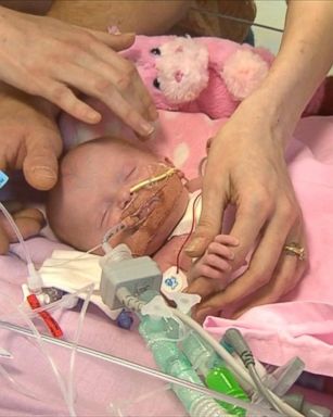 VIDEO: Surgeons successfully operated on Vanellope Hope, who was born with her heart growing outside of her body.