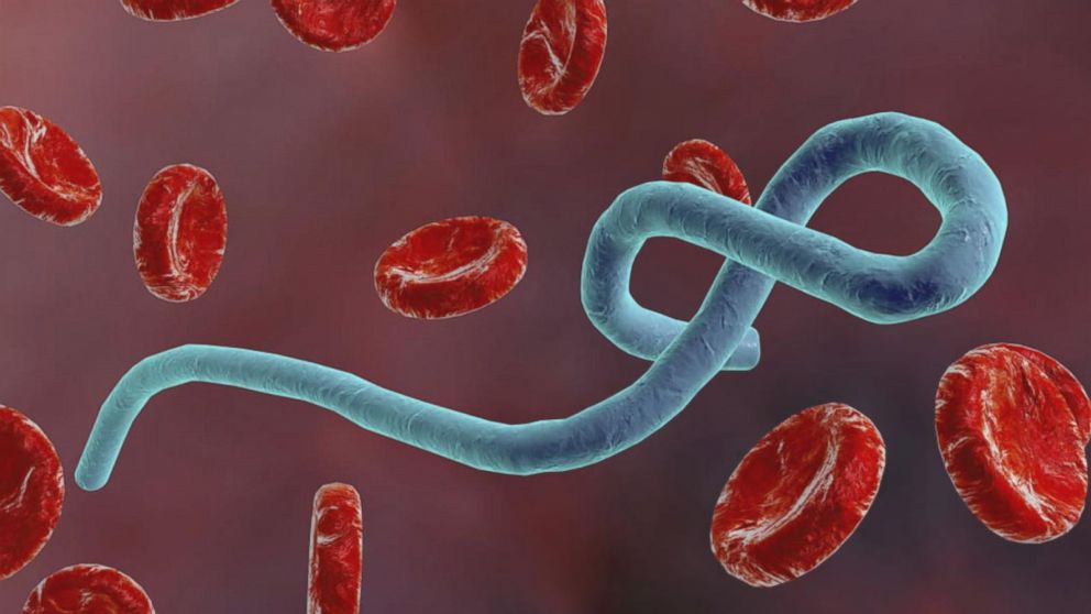 virusi ebola paraziti kod dece ishrana