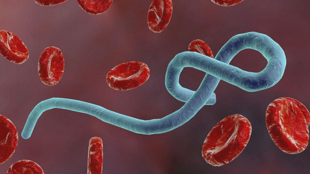 What is Ebola? Video - ABC News