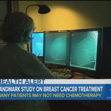 VIDEO: Chemo may not be necessary for breast cancer patients: Study