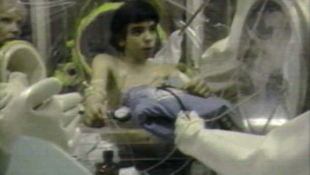 Video Bubble Boy David Vetter Receives Bone Marrow Transplant In 1983 Abc News