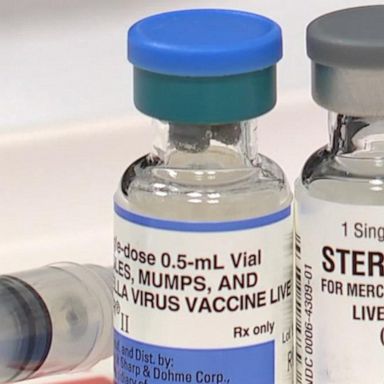 VIDEO: CDC: 704 confirmed cases of measles throughout U.S.