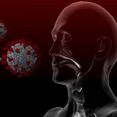 PHOTO: People are exposed to a coronavirus through mucus membranes of the eyes, nose and mouth via respiratory droplets.