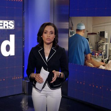 VIDEO: By the Numbers: Colon cancer screenings should begin at age 45