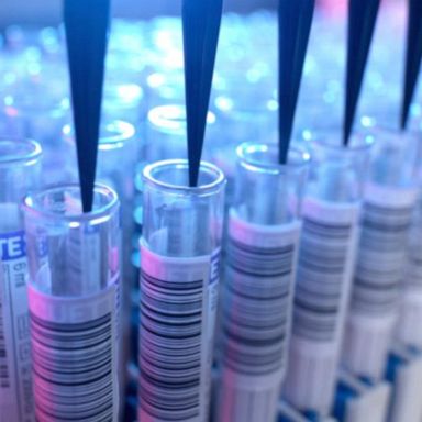 Researchers revealed on Tuesday that an American has likely been cured of HIV after undergoing a new transplant procedure using donated umbilical cord blood.