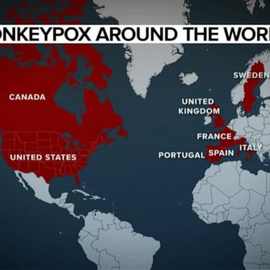 VIDEO: Concerns over monkeypox in the United States