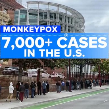 VIDEO: United States reports over 7,000 monkeypox cases