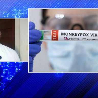 VIDEO: FDA expands monkeypox vaccine access by dividing doses