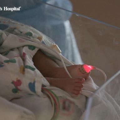 VIDEO: Childhood RSV cases rising, overwhelming pediatric hospital wards