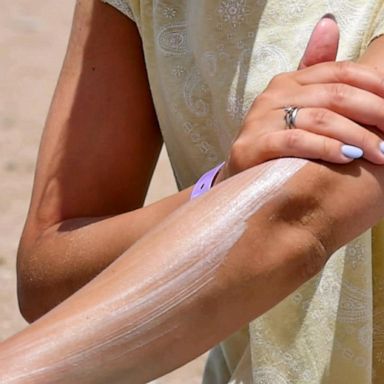 VIDEO: Patel It Like It Is: The importance of wearing sunscreen 