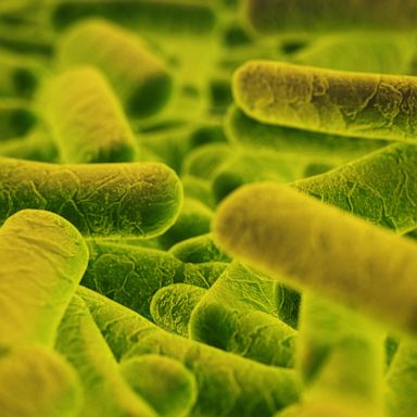 Symptoms of Listeria infection usually start within two weeks after eating contaminated food.