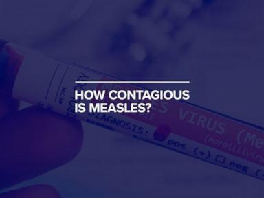 WATCH:  How contagious is measles?