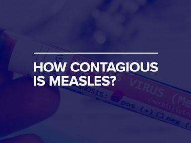 WATCH:  How contagious is measles?