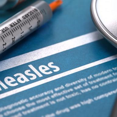 Debunking RFK Jr.'s measles claims