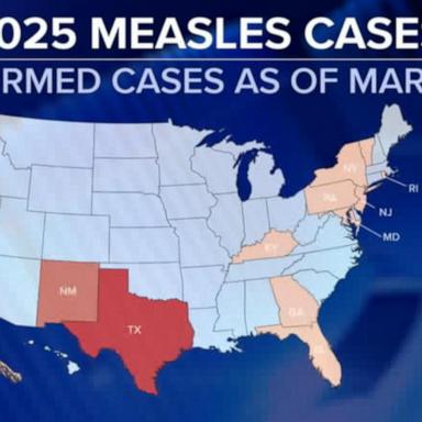 VIDEO: Measles cases grow as RFK Jr. makes controversial claims about treatment