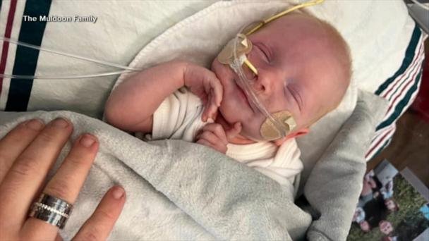 Doctors saved baby's life with gene fix for deadly rare disease