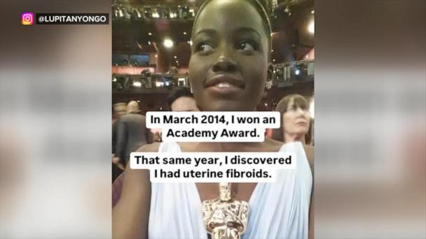 Oscar-winning actress Lupita Nyong’o shares experience with uterine fibroids