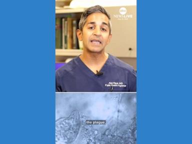 WATCH: What to know about the plague