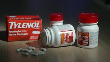 VIDEO: Tylenol during pregnancy has no link to autism, large study finds