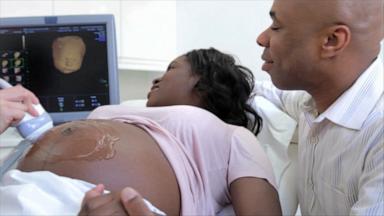 VIDEO: Black maternal mortality climbs, CDC data shows