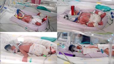 A woman has given birth to naturally conceived identical quadruplet daughters, all sharing one placenta and developing from a single fertilized egg in one of the few cases of its kind in the world.