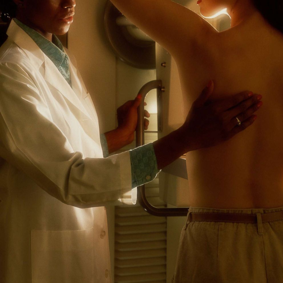 PHOTO: A woman is screened for breast cancer in this stock photo.