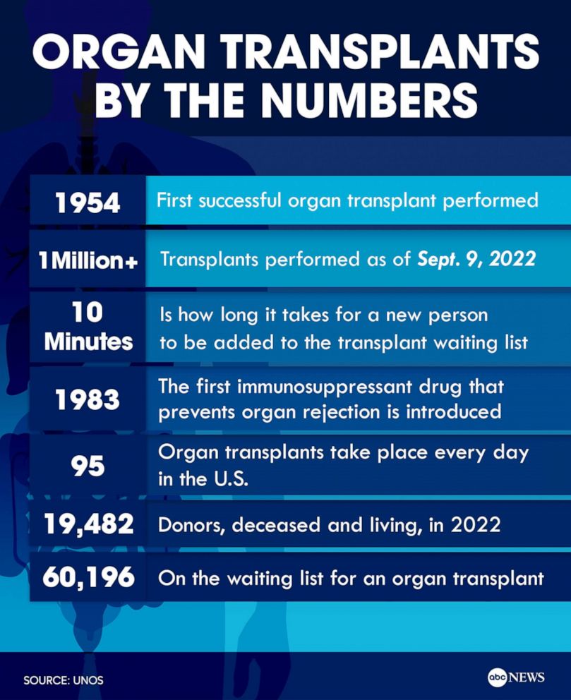 PHOTO: Organ transplants by the numbers
