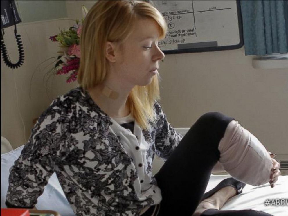 PHOTO: Adrianne Haslet-Davis spent a year doing physical therapy after losing part of her leg in the Boston bombings attack, April 15, 2013.