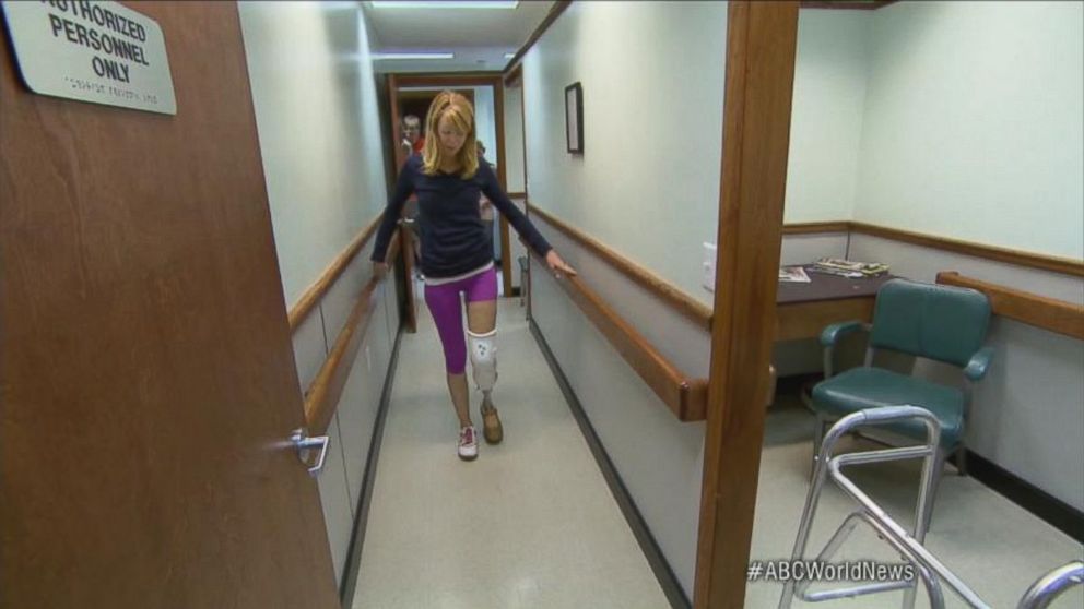 PHOTO: Adrianne Haslet-Davis practices physical therapy exercises with her prosthetic leg. 