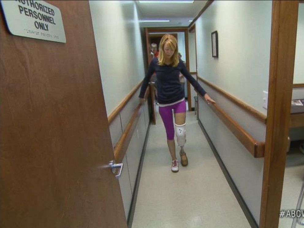 PHOTO: Adrianne Haslet-Davis practices physical therapy exercises with her prosthetic leg.