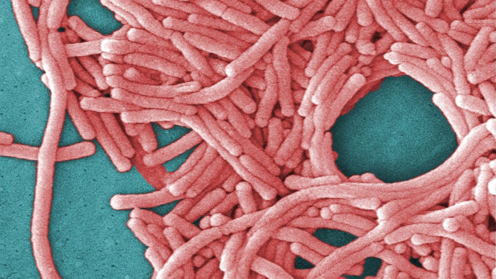 This undated image made available by the Centers for Disease Control and Prevention shows a large grouping of Legionella pneumophila bacteria (Legionnaires' disease). 