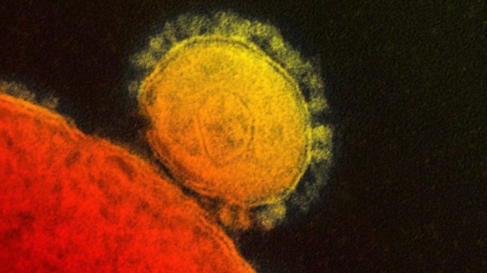 This file photo provided by the National Institute for Allergy and Infectious Diseases shows a colorized transmission of the MERS coronavirus that emerged in 2012.