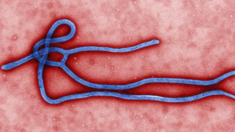 This undated file image made available by the CDC shows the Ebola Virus. 